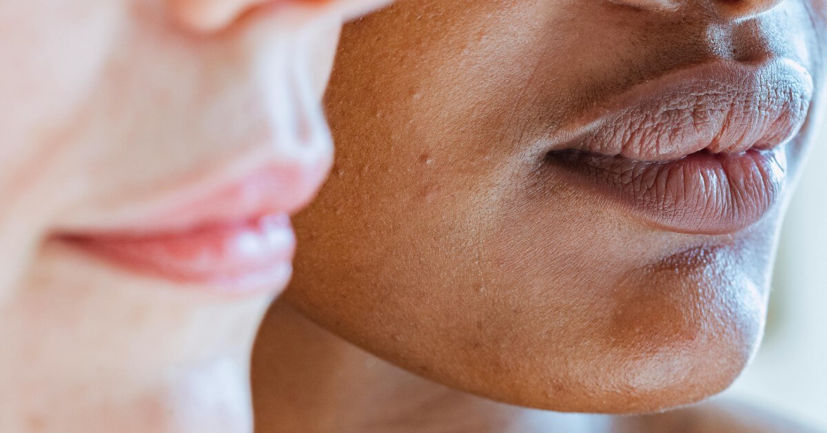 Understanding Your Skin Type: A Comprehensive Guide